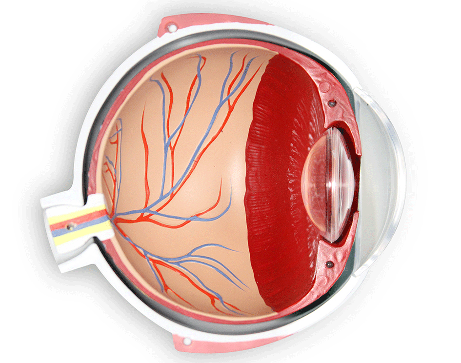 Image informative nous montrant la position de la cataracte dans l'œil